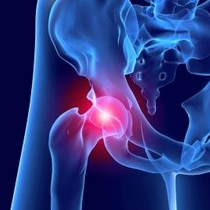 Hip Preservation